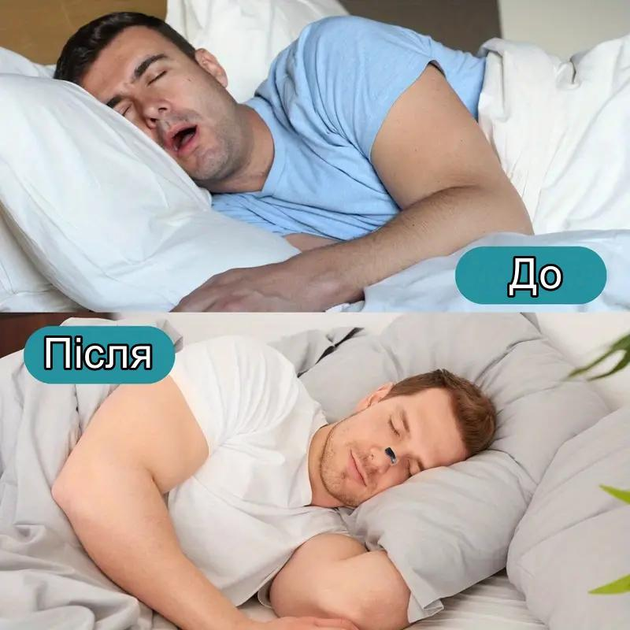 6651052144_nazalnij-magnitnij-rozshiryuvach.png 6651052144_nazalnij-magnitnij-rozshiryuvach.png