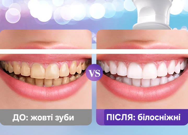 6899967423_fioletova-vidbilyuyucha-geleva.png 6899967423_fioletova-vidbilyuyucha-geleva.png