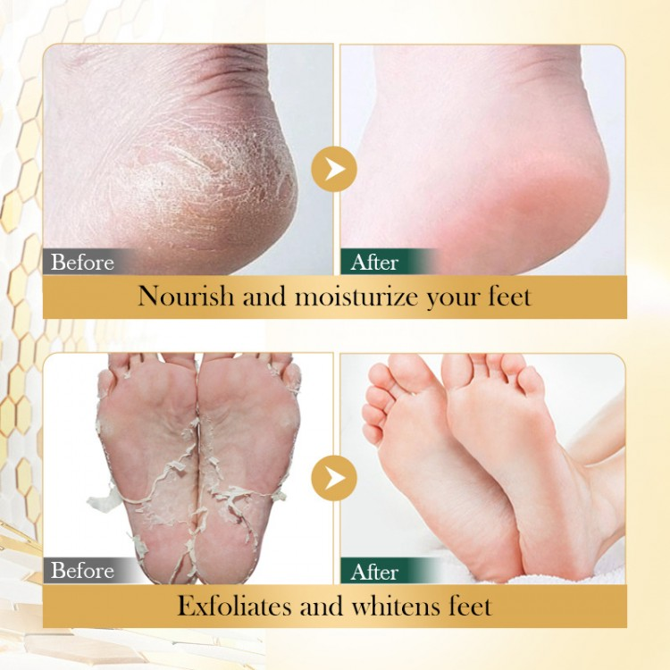 7269442772_nosochki-dlya-nig.png 7269442772_nosochki-dlya-nig.png